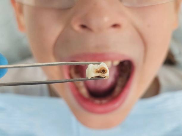 Best Emergency Treatment for Toothache in Orange, TX